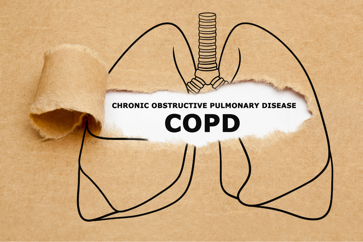 Chronisch obstruktive Bronchitis